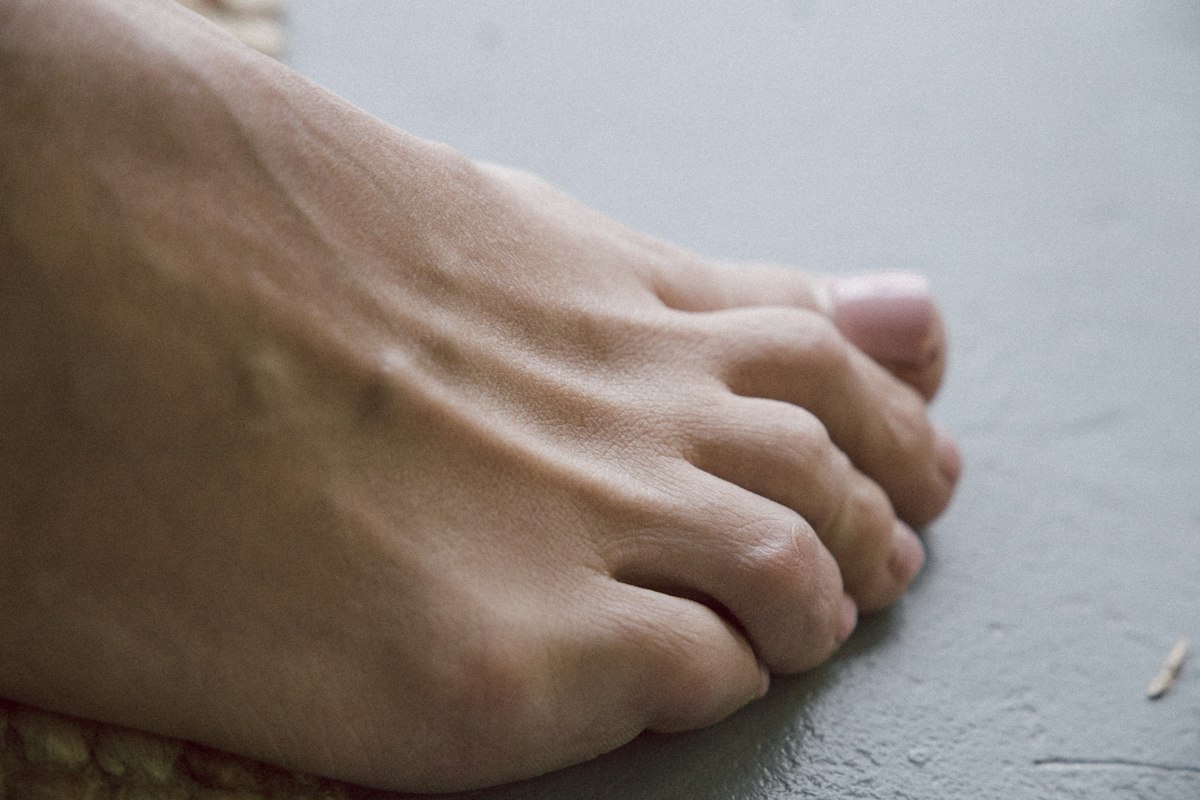Neuropatía diabética: cambios en el cuerpo